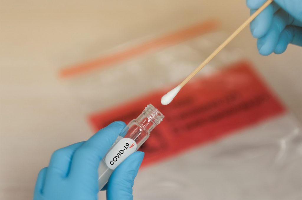 coronavirus test scaled