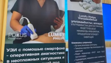 uzi kontrolya